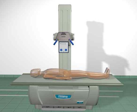 AUTOMATIC TUBE-DETECTOR VERTICAL FOCAL DISTANCE The BTE tabletop is typically lowered to its minimum height to facilitate patient access (especially important with elderly/disabled patients).