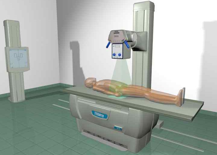 AUTOMATIC HORIZONTAL TUBE DETECTOR CENTERING AND COLLIMATION When performing examinations on the BTE elevating table, the detector automatically follows the X- ray tube movements thus guaranteeing