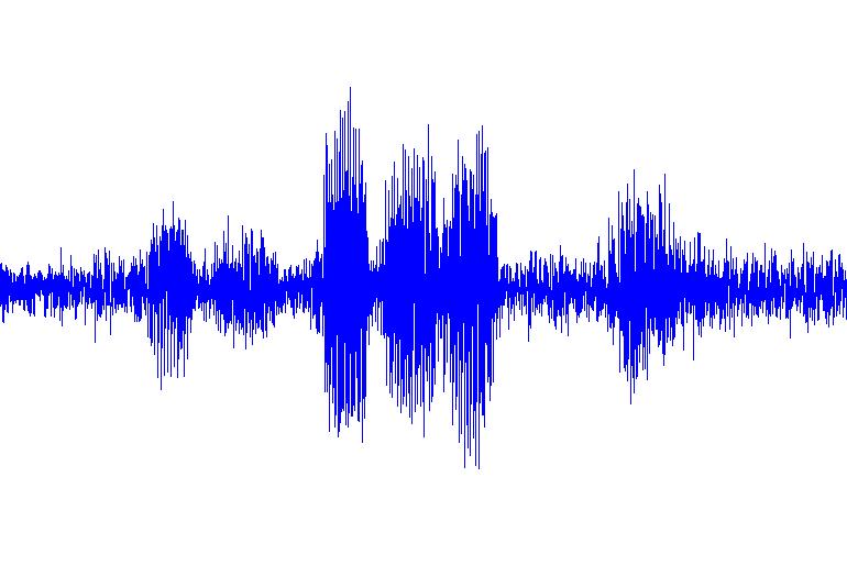 IDIAP RR 7-7 noisy speech x( i) STFT X noise estimation original filter G Ŝ α α Y post filter G Ŝ sˆ( i) ISTFT OLA G Figure : Diagram of the proposed algorithms.