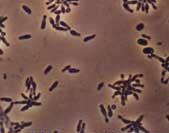 Effective Microorganisms EM, EM-1 Combination of 3