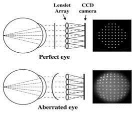 Wavefront/Aberrations: A complex way to describe the total refractive error of the eye.