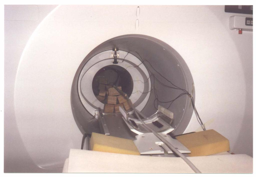 Disposition of the equipment inside the scanner bore for the investigation of its vibration and acoustic behaviours (WBIC Cambridge Scanner). 4. RESULTS OF THE MEASUREMENTS.