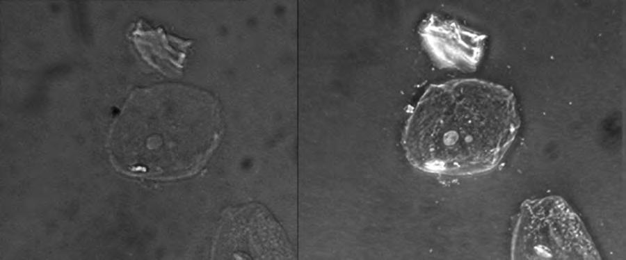 Because it increases contrast without requiring stains, phase-contrast microscopy is often used to observe live specimens.