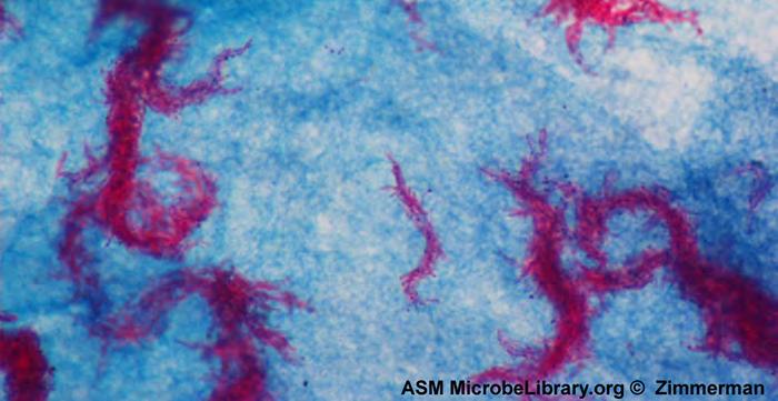 Chapter 2 How We See the Invisible World 77 Figure 2.36 Ziehl-Neelsen staining has rendered these Mycobacterium tuberculosis cells red and the surrounding growth indicator medium blue.