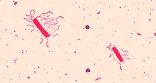 Figure 2.39 A flagella stain of Bacillus cereus, a common cause of foodborne illness, reveals that the cells have numerous flagella, used for locomotion.