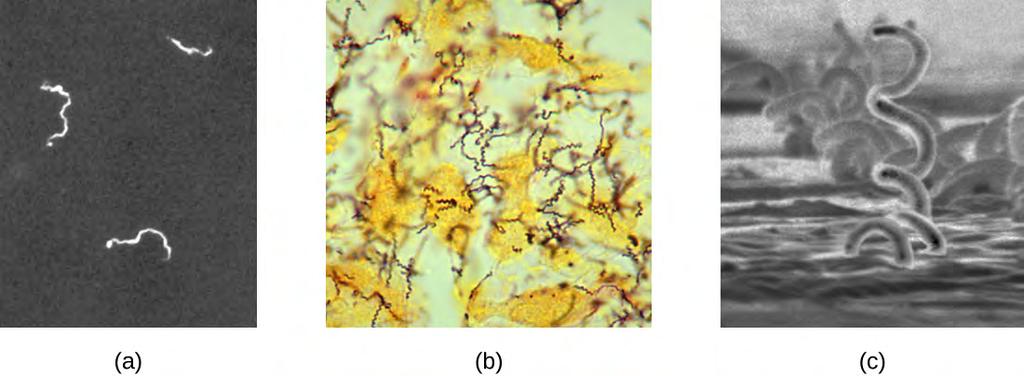 Figure 2.43 (a) Living, unstained Treponema pallidum spirochetes can be viewed under a darkfield microscope. (b) In this brightfield image, a modified Steiner silver stain is used to visualized T.