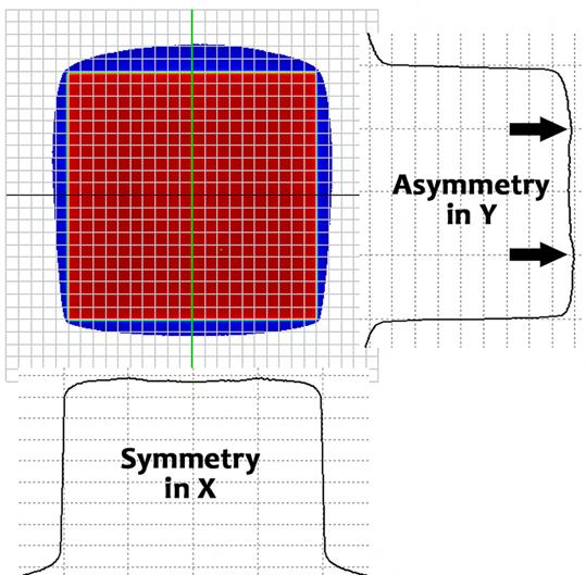 Figure 4 This example shows a large IMRT segment which overlaps one of the extreme Y borders of the EPID (panel A).