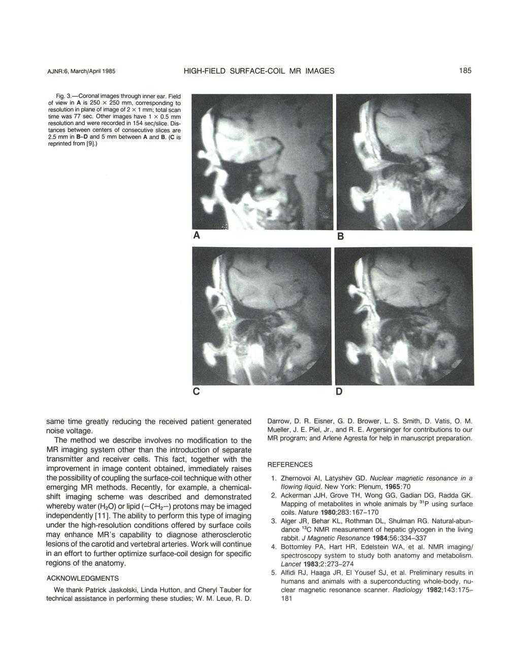 AJNR:6, March/April 1985 HIGH-FIELD SURFACE-COIL MR IMAGES 185 Fig. 3.-Coronal images through inner ear.