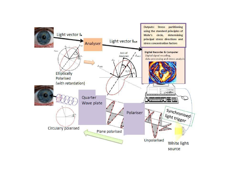 Previous studies on birefringent measurements in human eyes are mainlyfocused on the medical treatments Stress distribution in cornea could result due to the inherent molecular architecture of the