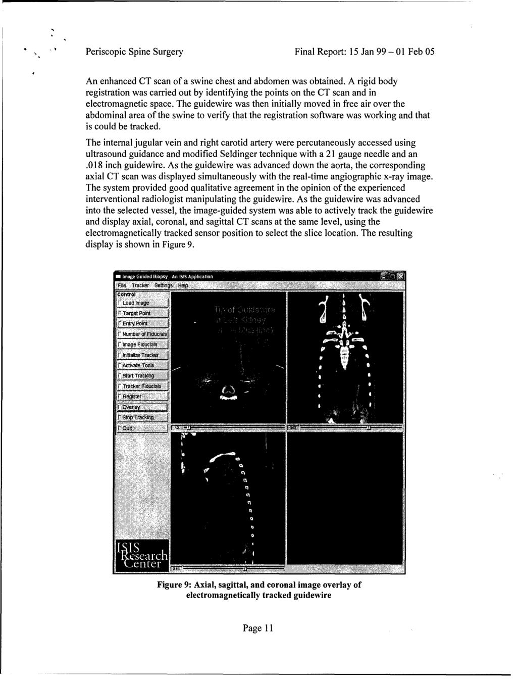 Periscopic Spine Surgery Final Report: 15 Jan 99-01 Feb 05 An enhanced CT scan of a swine chest and abdomen was obtained.