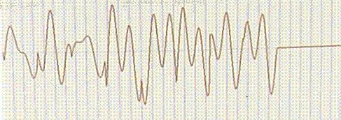 group (6 persons) worked out a system which we call the adaptive modem. We present here for the first time some waveforms made by our prototype in the tests, Figures 6-9.