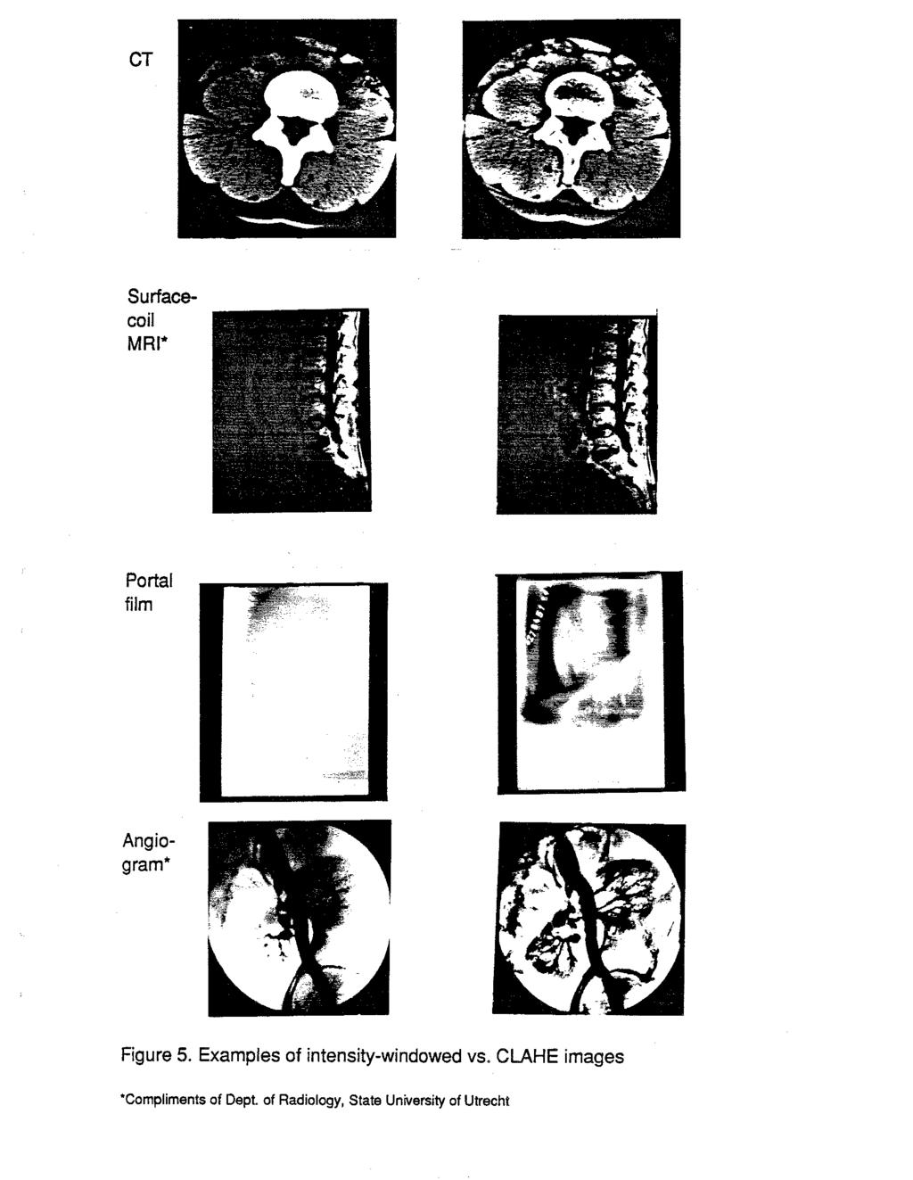 CT Surfacecoil MRI* Portal film Angiogram* Figure 5.