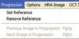 Set a Reference for a Follow-Up Scan How to Set a Reference for a Follow-Up Scan Figure 22: