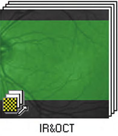 Images in the series are designated by small boxes on the image icon (Figure 72). 2.