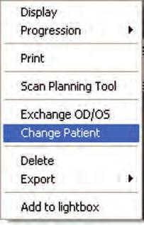 Transfer Patient Images How to Transfer Images Between Patient Records Figure 74: No Split Icon Figure 75: Select Change Patient 1.