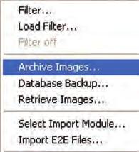 Archive Images How to Archive Images Figure 78: Database Icon Figure 79: Unload Icon 1.