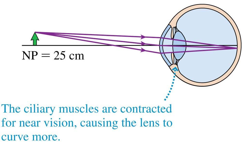 Focusing and Accommodation The closest distance at which an eye can