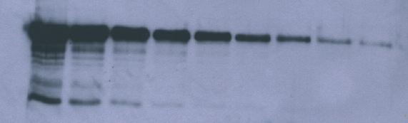 Fig 1. Western blot detection with Kodak BioMax Light and films.