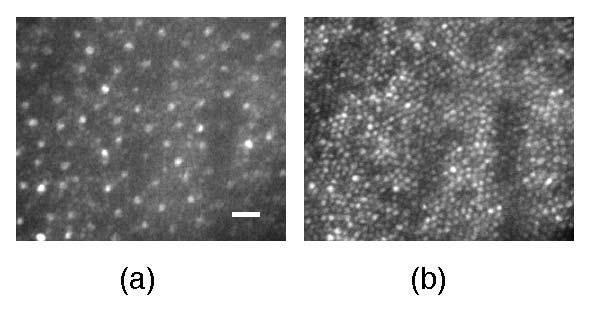 Applications of Adaptive Optics for Vision Science 119 classify individual cones by taking and comparing images of the photoreceptor mosaic when the photopigment was fully bleached to those when the