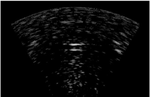Ultrasound Images: (a) Volume rendered pulse-echo image of the phantom.