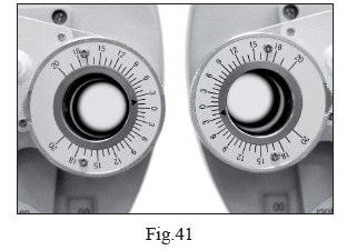weak spherical power dial is used to adjust myopia (and strong spherical power dial is used to adjust hyperopia).