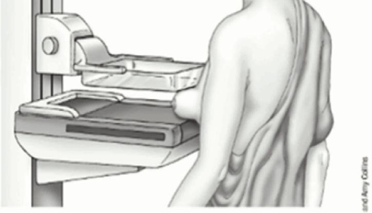 Mammogram examination [7].