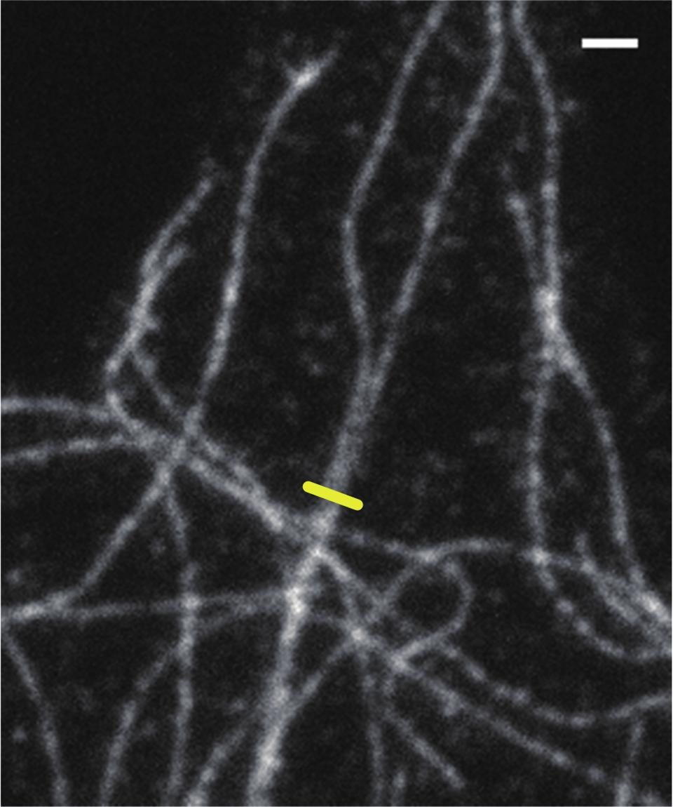 Development of a High-speed Super-resolution Confocal Scanner of the images obtained by the high-speed super-resolution confocal scanner was about 160 nm before deconvolution (about 40% higher than