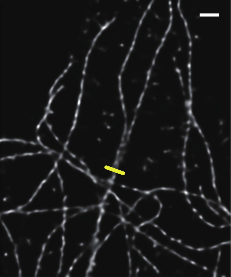 Figure 6(A) shows images taken by a conventional epifluorescence system, and Figure 6(B) shows images taken by the high-speed superresolution confocal scanner.