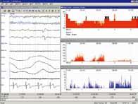 and review Voltage mapping and waveform view EEG TrendScope Sleep analysis software: Polysmith QP-260AK Display, store and analyze sleep data