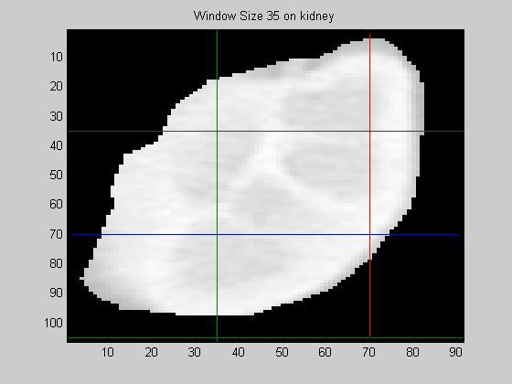 window size of 35 pixels. Smaller windows markedly degrade the texture classification performance.
