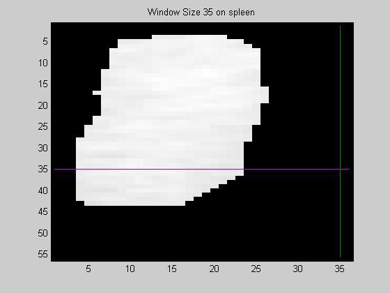 proportion of a 35 pixel window over both a liver and spleen.