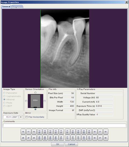 2D IMAGING MODULE Horizontal image toolbar Show image properties Opens the General tab under Image properties window where the tooth numbers (for intraoral images) can be defined, the image can be