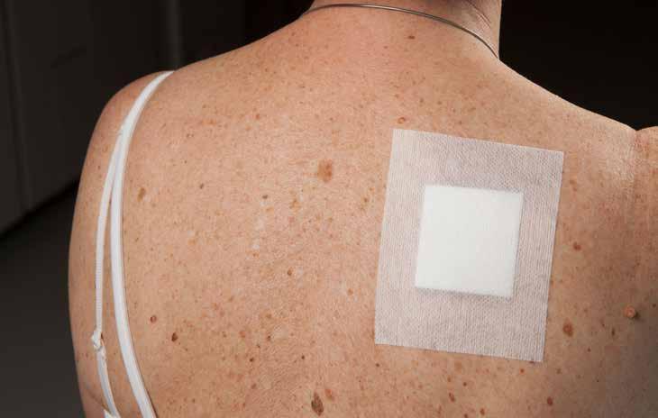 Post-op Dressings Post-op Dressings Protective wound dressing for light to moderately secreating wounds. Dressings combine an absorbent pad with a soft and conformable fixative layer.