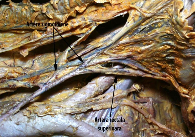 colică stângă din artera mezenterică inferioară și în 7 cazuri au fost ramuri direct din artera mezenterică inferioară și în 3 cazuri a existat un trunchi sigmoidian.