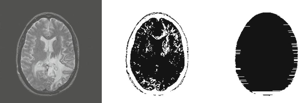 Fig. 2 The segmentation of Brain medical image gray color [8].