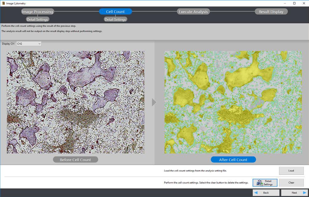 Image Processing Selects the image processing to be applied as preprocessing of the cell count.