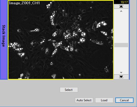 Select images manually 3 Move the Z-stack slider at the right of the image display area (lower level), and select an image with the best focus. 4 Click the [Select] button under the image.