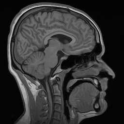 MRI Head