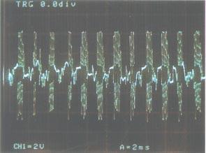 Furthermore, the recovered signals are saturated in the negative regions.
