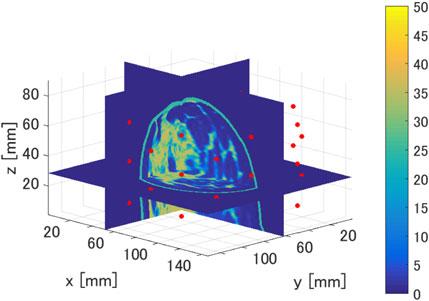 tdoa-based microwave imaging algorithm for real-time microwave ablation monitoring 7 Fig. 13.