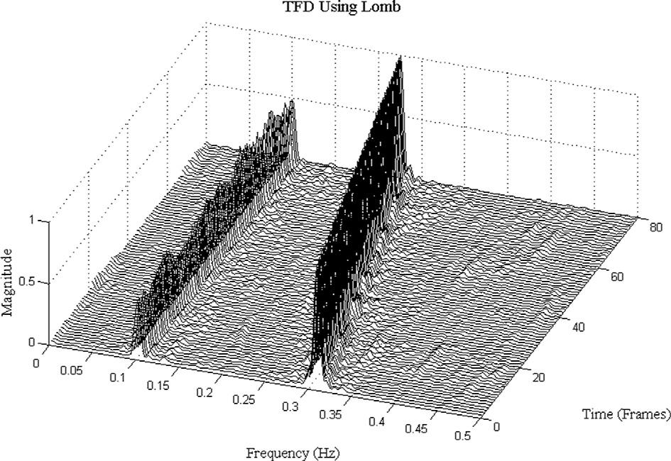 1498 W.-C. Fang et al. / Expert Systems with Applications 40 (2013) 1491 1504 ing time frequency distribution using the Lomb periodogram is shown in Fig. 13.