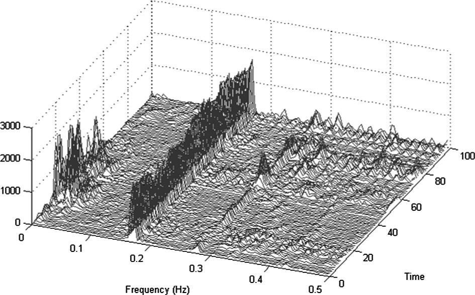 W.-C. Fang et al. / Expert Systems with Applications 40 (2013) 1491 1504 1499 Fig. 15. Time frequency HRV analysis using Lomb TFD of ECG data from the MIT-BIH arrhythmia database. Fig. 16.