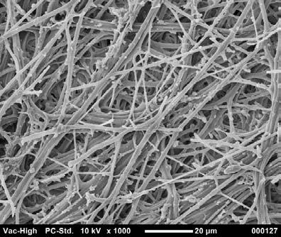 Glomerulus, Secondary electron image, original mag: 5,000 (with coating) Lung alveolus
