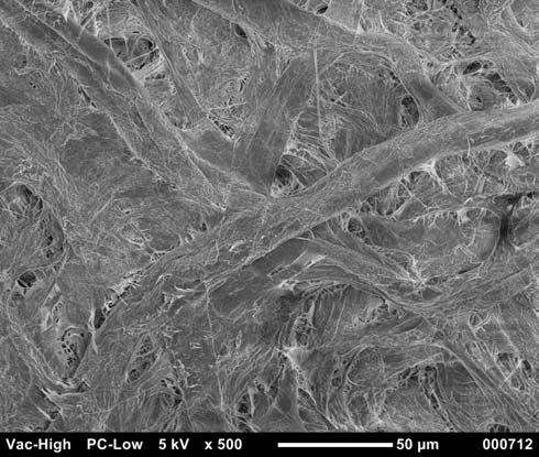 Mold grown on paulowia leaf (no coating, frame accumulation), Secondary electron image, original mag:
