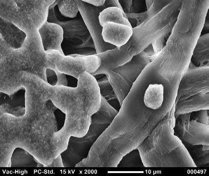 Table Top SEM Observation Let's observe in the high vacuum mode A secondary electron image appears