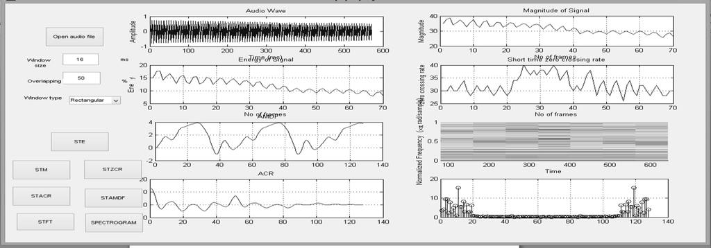 IV.SPEECH ANALYSIS IN FREQUENCY DOMAIN 4.1. Short time Fourier transforms Time varying spectral information is taken into account hence, the short time processing approach is employed.