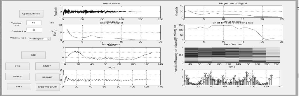Figure 3.GUI model showing results of algorithms of unvoiced speech (/sh/) Short time energy and magnitude is useful in detecting voiced segments of speech.