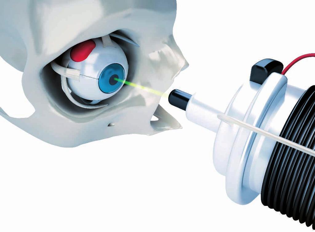 Markets and Applications Piezomotors position a laser for use in an eye surgery application fast and reliably The XY stage with PILine technology ensures fast probing