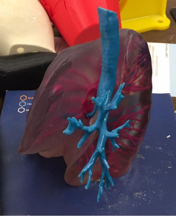 lung printed in