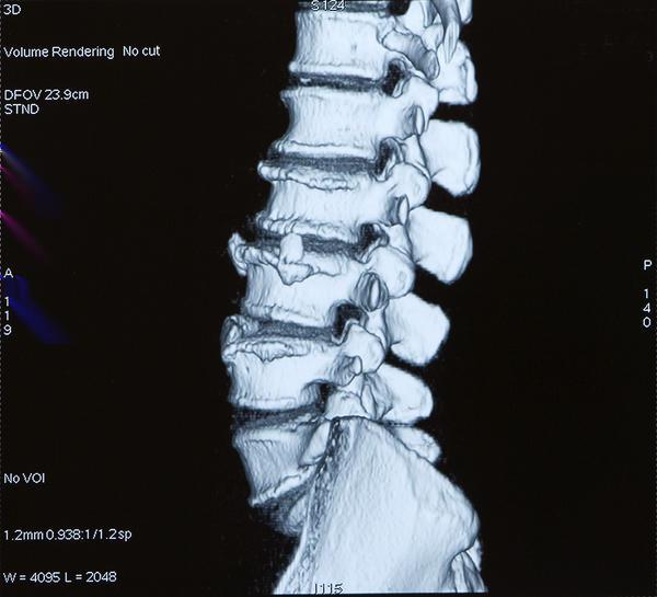 Figure 5. Heart attack ECG. Figure 8. Spinal Cord injured patient ECG. Figure 6. Crohn s disease.